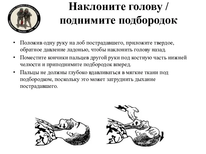 Наклоните голову / поднимите подбородок Положив одну руку на лоб пострадавшего, приложите