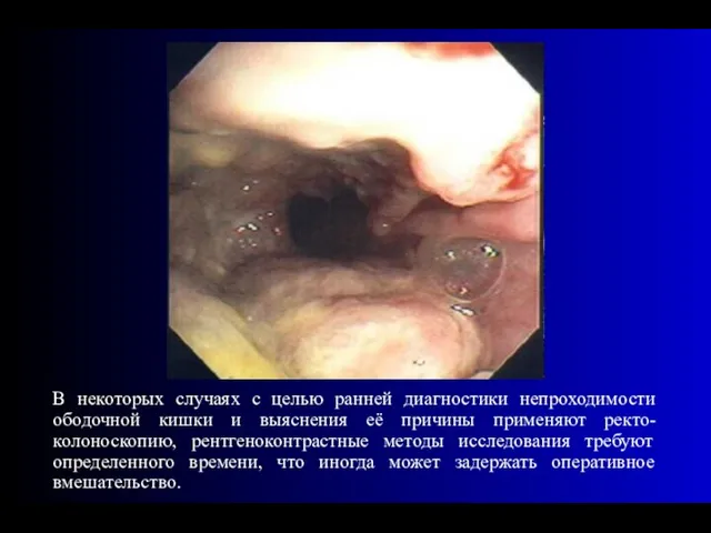 В некоторых случаях с целью ранней диагностики непроходимости ободочной кишки и выяснения