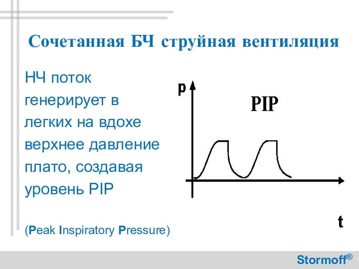 Сочетанная БЧ струйная вентиляция НЧ поток генерирует в легких на вдохе верхнее