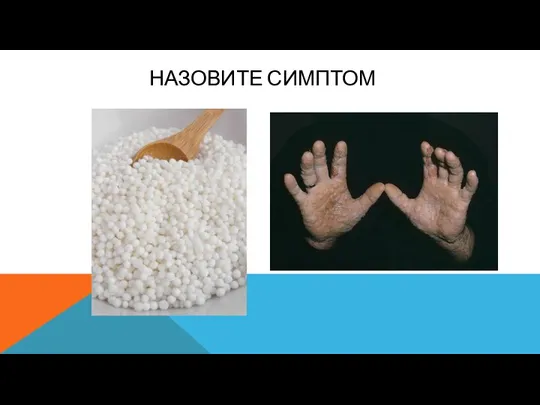 НАЗОВИТЕ СИМПТОМ