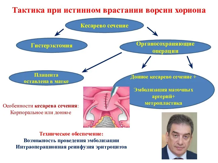 Тактика при истинном врастании ворсин хориона Гистерэктомия Органосохраняющие операции Плацента оставлена в