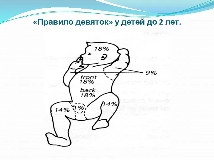 «Правило девяток» у детей до 2 лет.