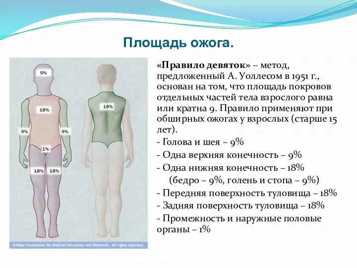 Площадь ожога. «Правило девяток» – метод, предложенный А. Уоллесом в 1951 г.,