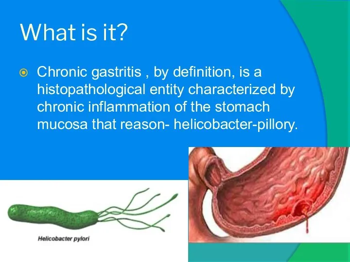 What is it? Chronic gastritis , by definition, is a histopathological entity