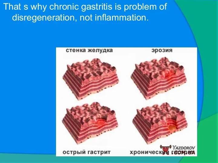 That s why chronic gastritis is problem of disregeneration, not inflammation.