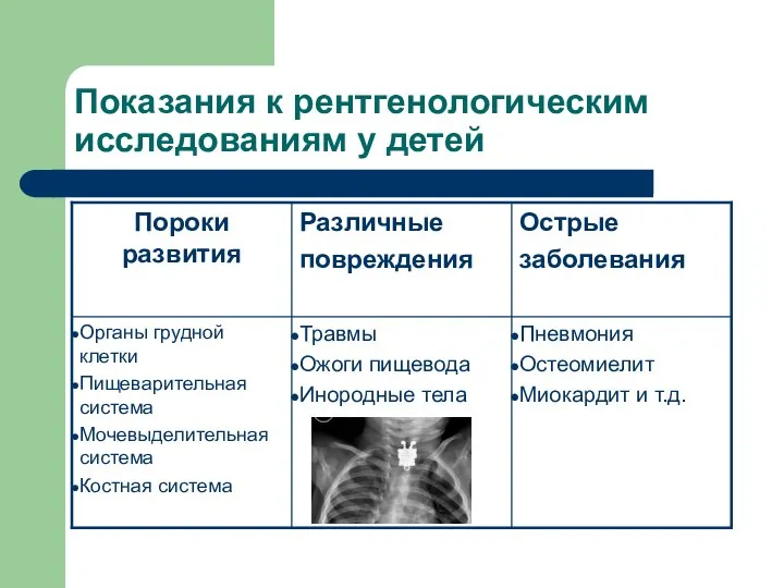 Показания к рентгенологическим исследованиям у детей