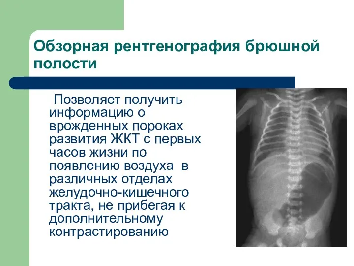 Обзорная рентгенография брюшной полости Позволяет получить информацию о врожденных пороках развития ЖКТ
