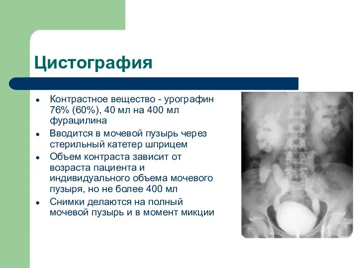 Цистография Контрастное вещество - урографин 76% (60%), 40 мл на 400 мл