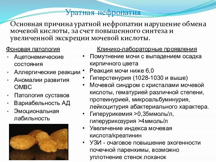 Уратная нефропатия Основная причина уратной нефропатии нарушение обмена мочевой кислоты, за счет