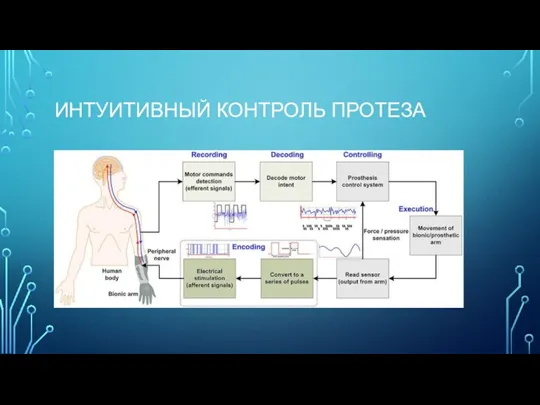 ИНТУИТИВНЫЙ КОНТРОЛЬ ПРОТЕЗА