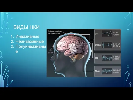 ВИДЫ НКИ Инвазивные Неинвазивные Полуинвазивные