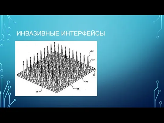 ИНВАЗИВНЫЕ ИНТЕРФЕЙСЫ