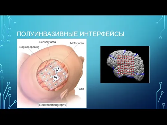 ПОЛУИНВАЗИВНЫЕ ИНТЕРФЕЙСЫ