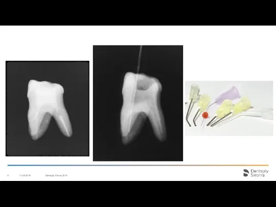 11-04-2018 Dentsply Sirona 2016