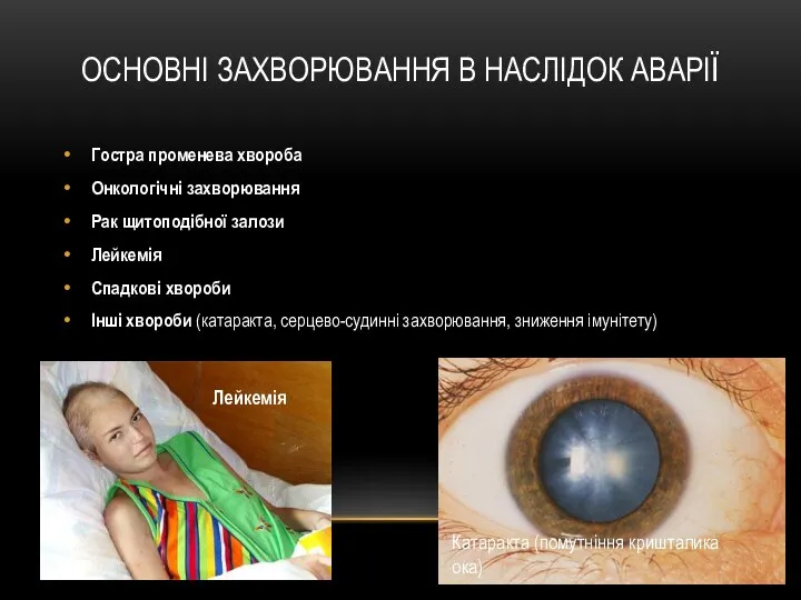 ОСНОВНІ ЗАХВОРЮВАННЯ В НАСЛІДОК АВАРІЇ Гостра променева хвороба Онкологічні захворювання Рак щитоподібної