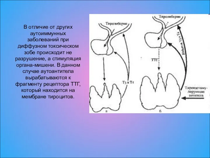 В отличие от других аутоиммунных заболеваний при диффузном токсическом зобе происходит не