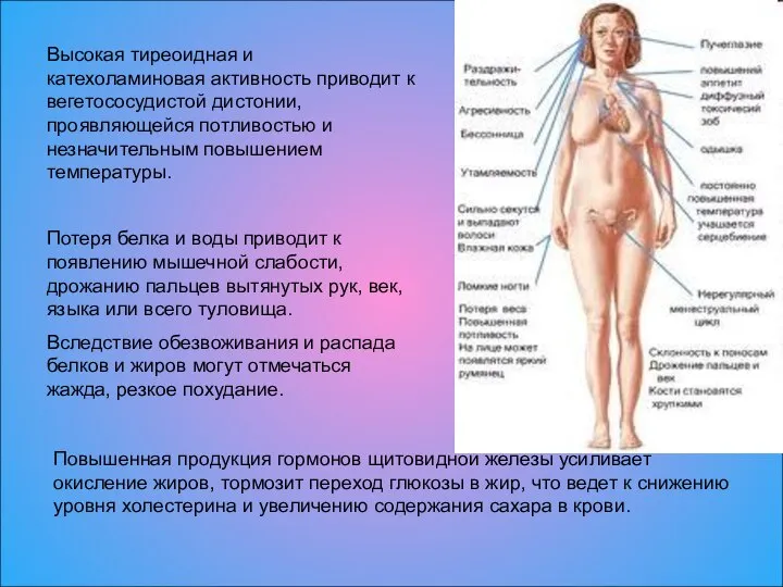 Высокая тиреоидная и катехоламиновая активность приводит к вегетососудистой дистонии, проявляющейся потливостью и