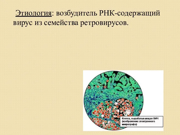 Этиология: возбудитель РНК-содержащий вирус из семейства ретровирусов.