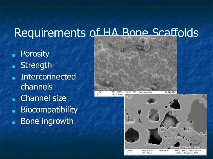 Requirements of HA Bone Scaffolds Porosity Strength Interconnected channels Channel size Biocompatibility
