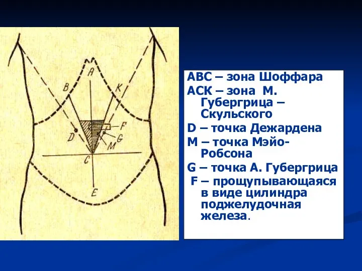 АВС – зона Шоффара АСК – зона М.Губергрица – Скульского D –