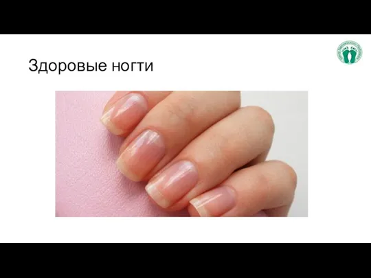 Здоровые ногти