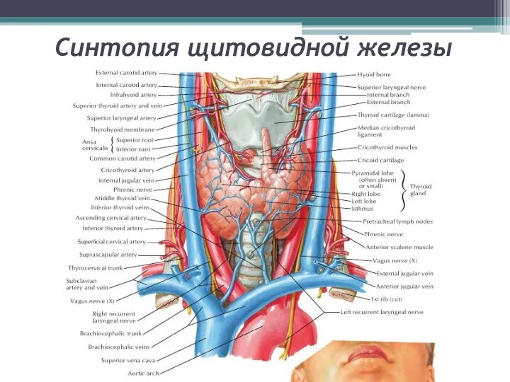 Синтопия щитовидной железы