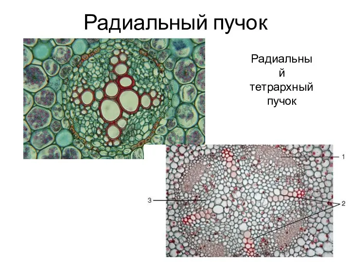 Радиальный пучок Радиальный тетрархный пучок