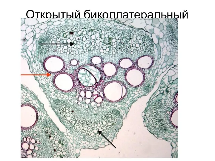 Открытый биколлатеральный пучок