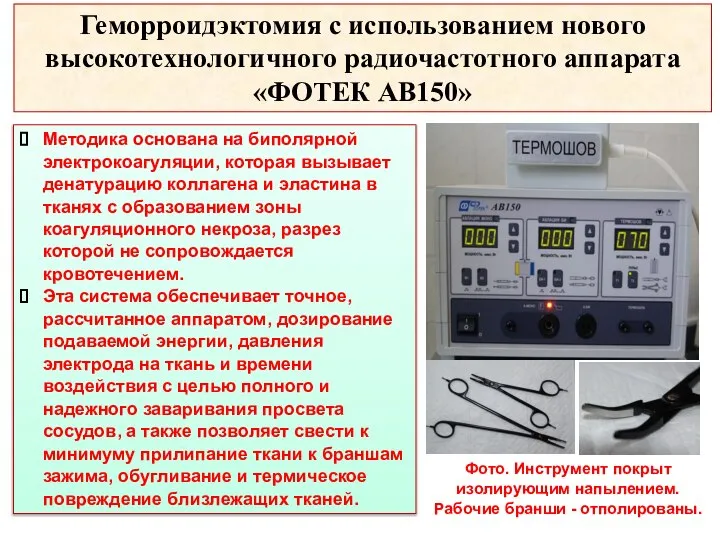 Геморроидэктомия с использованием нового высокотехнологичного радиочастотного аппарата «ФОТЕК АВ150» Методика основана на