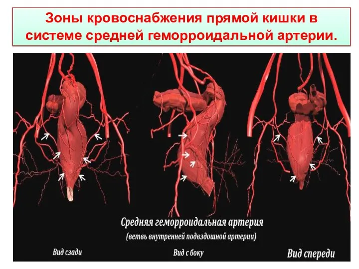 Зоны кровоснабжения прямой кишки в системе средней геморроидальной артерии.