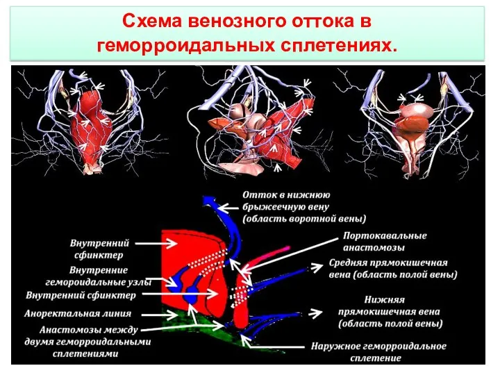 Схема венозного оттока в геморроидальных сплетениях.