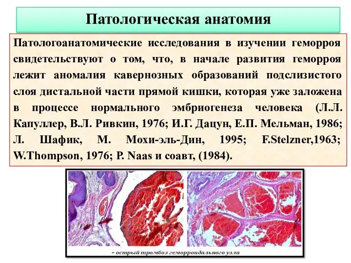 Патологическая анатомия Патологоанатомические исследования в изучении геморроя свидетельствуют о том, что, в