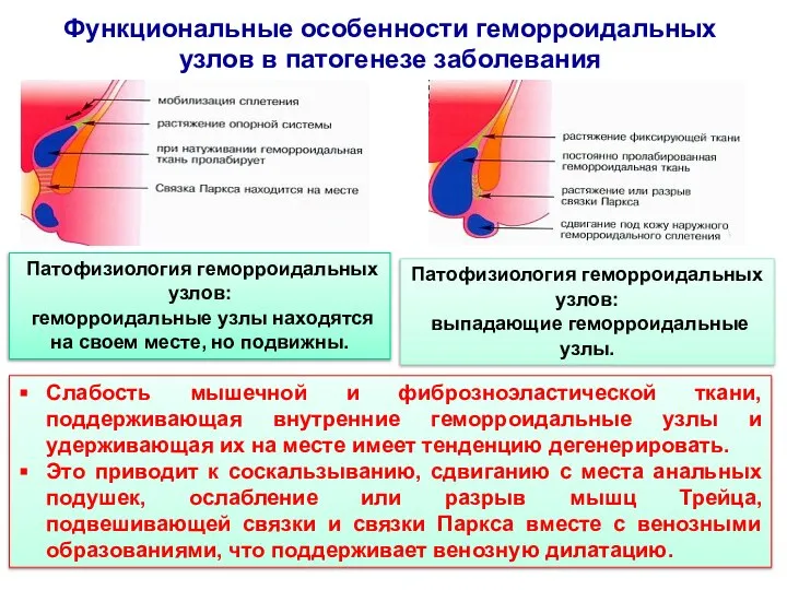 Функциональные особенности геморроидальных узлов в патогенезе заболевания Слабость мышечной и фиброзноэластической ткани,