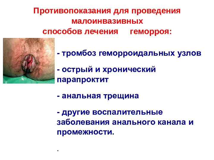 - тромбоз геморроидальных узлов - острый и хронический парапроктит - анальная трещина