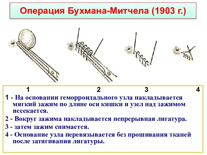 Операция Бухмана-Митчела (1903 г.) 1 2 3 4 1 - На основании