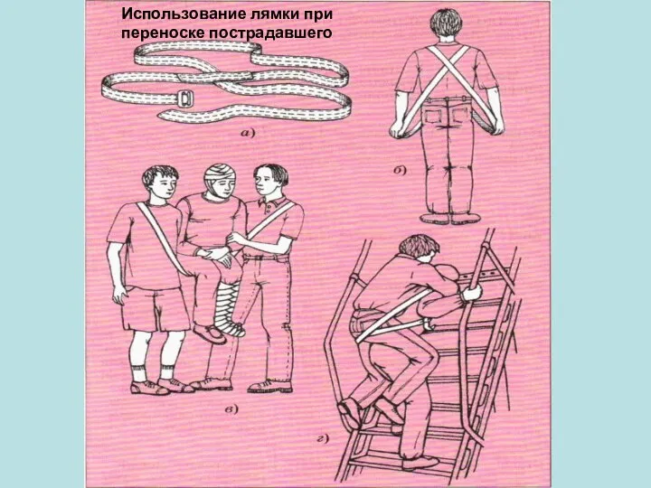 Использование лямки при переноске пострадавшего