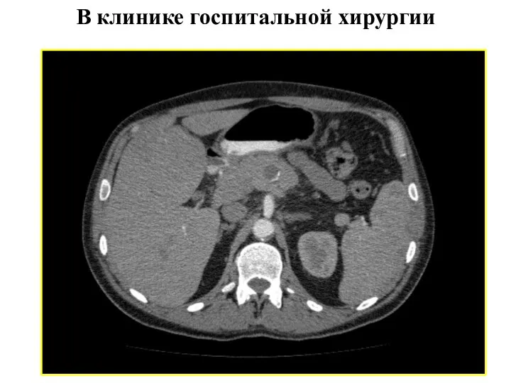 В клинике госпитальной хирургии