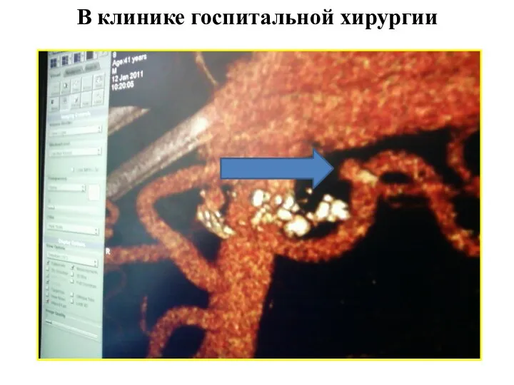 В клинике госпитальной хирургии