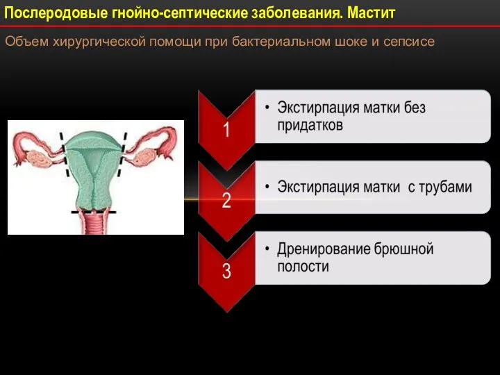 Послеродовые гнойно-септические заболевания. Мастит Объем хирургической помощи при бактериальном шоке и сепсисе