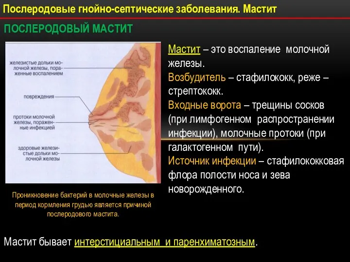 Послеродовые гнойно-септические заболевания. Мастит ПОСЛЕРОДОВЫЙ МАСТИТ Мастит – это воспаление молочной железы.