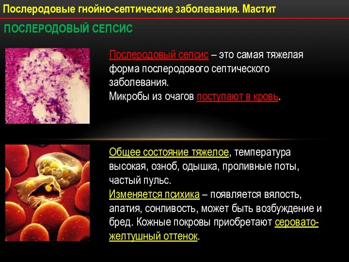 Послеродовые гнойно-септические заболевания. Мастит ПОСЛЕРОДОВЫЙ СЕПСИС Послеродовый сепсис – это самая тяжелая