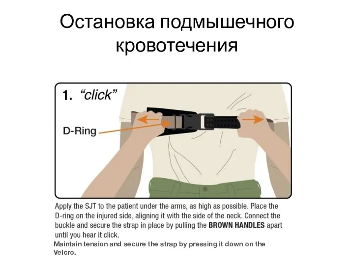 Остановка подмышечного кровотечения Maintain tension and secure the strap by pressing it down on the Velcro.