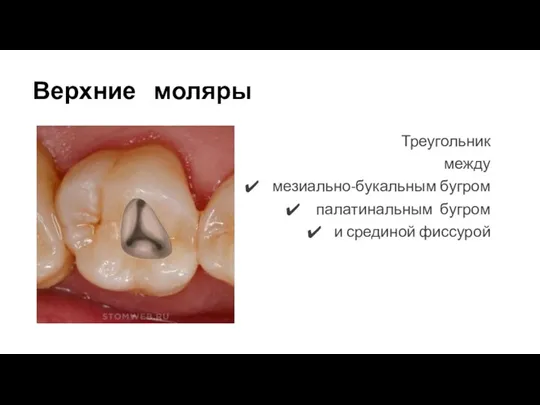 Верхние моляры Треугольник между мезиально-букальным бугром палатинальным бугром и срединой фиссурой