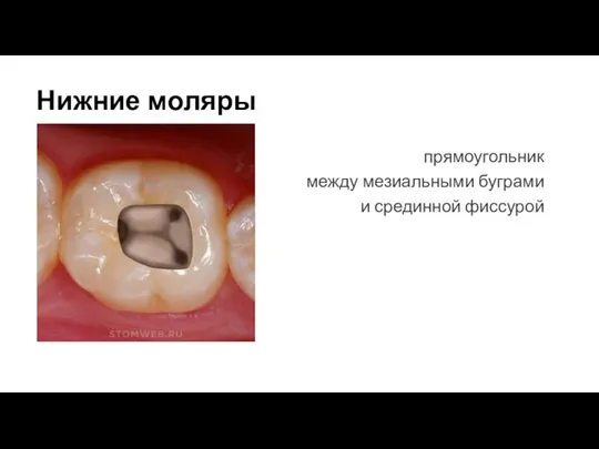 Нижние моляры прямоугольник между мезиальными буграми и срединной фиссурой