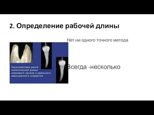 2. Определение рабочей длины Нет ни одного точного метода Всегда -несколько