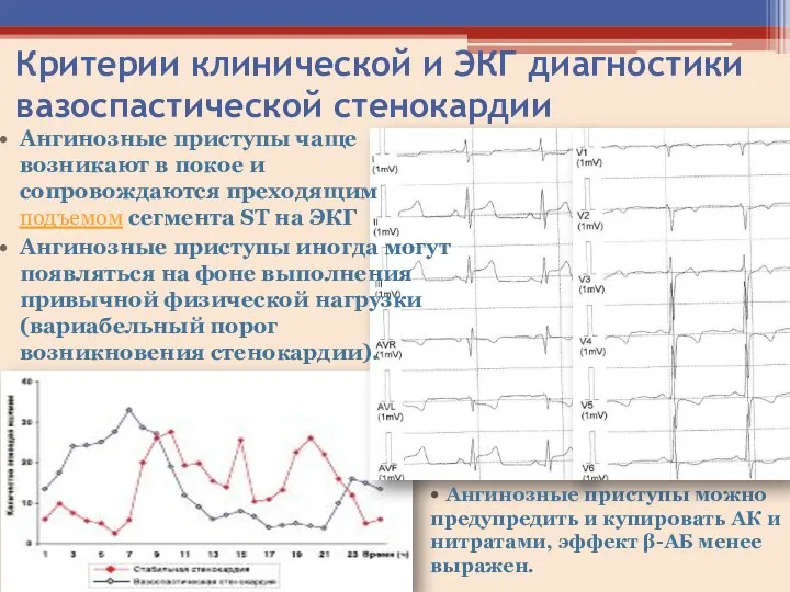 Критерии клинической и ЭКГ диагностики вазоспастической стенокардии Ангинозные приступы чаще возникают в