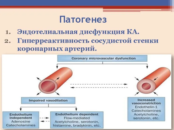 Патогенез Эндотелиальная дисфункция КА. Гиперреактивность сосудистой стенки коронарных артерий.