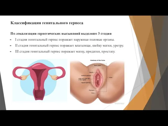 Классификация генитального герпеса По локализации герпетических высыпаний выделяют 3 стадии I стадия