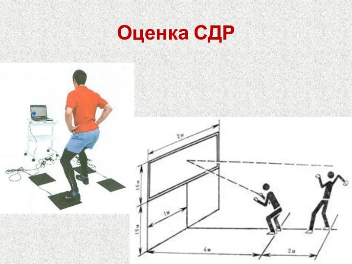 Оценка СДР