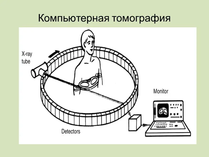 Компьютерная томография